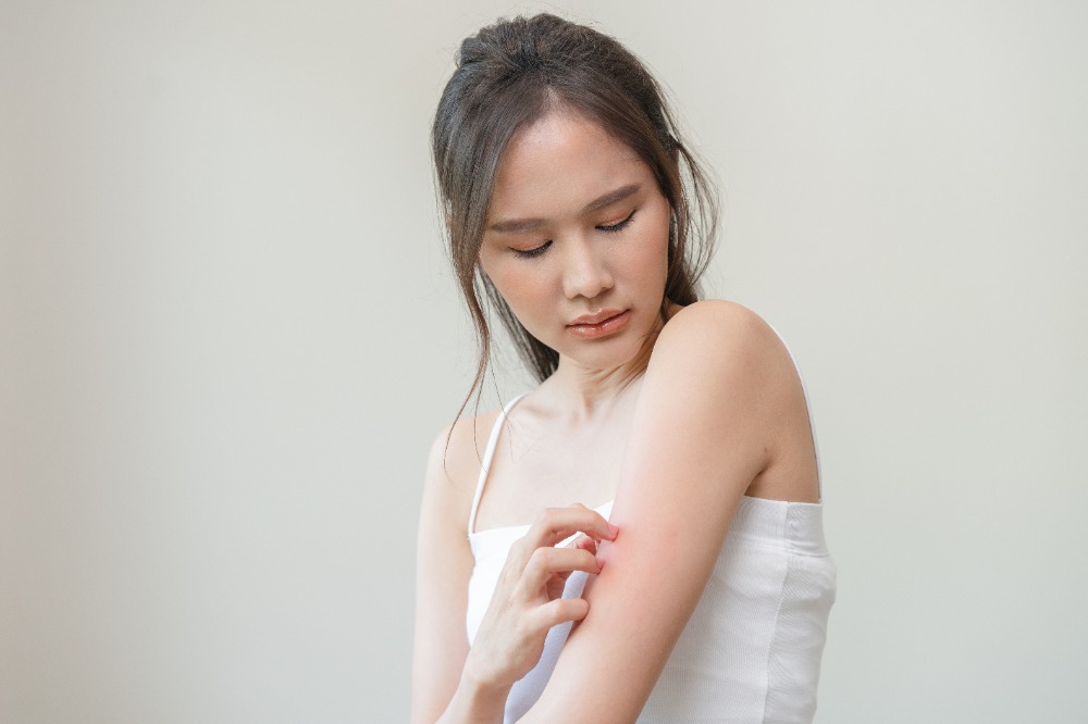 Skin Rashes & Eczema